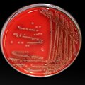 Photobacterium damselae colonies growing on the blood agar.