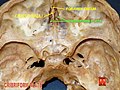 머리뼈바닥 - 볏돌기(crista galli), 체판(cribriform plate), 막구멍(foramen cecum)이 표시되었다.