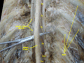 Spinal cord. Spinal membranes and nerve roots. Deep dissection. Posterior view.