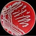 Bacillus licheniformis colonies growing on the blood agar.