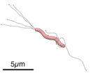 Helicobacter pylori