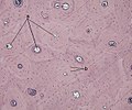 Hueso compacto: a. Conductos de Havers, b. Lagunas con osteocitos