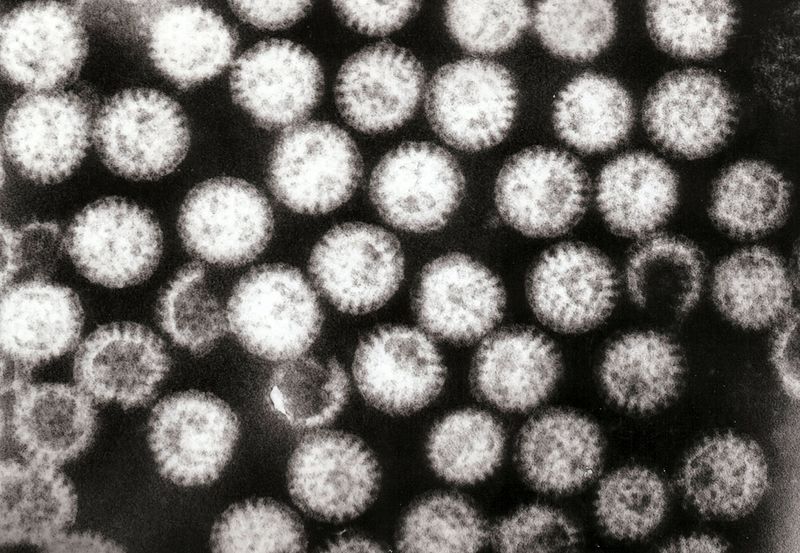 File:Multiple rotavirus particles.jpg