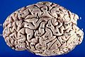 Human brain seen from top. Superior frontal sulcus labelled as #7.