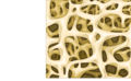 Spongy bone - Trabecular bone - Normal trabecular bone