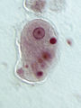 Entamoeba histolytica' trophozoite.