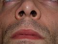 Human nostrils