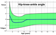 Hip-knee-ankle angle by age, with 95% prediction interval.[39]