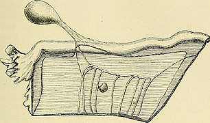 Clinical and pathological observations on tumours of the ovary, fallopian tube, and broad ligament (1884) (14785512313).jpg