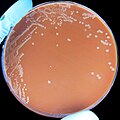 Haemophilus influenzae colonies growing on the chocolate agar.