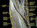 Vastus medialis muscle