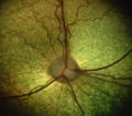 Image 48The dog's retina shows the optic disc and the eye's vasculature. (from Dog anatomy)