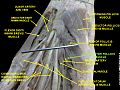 Adductor pollicis muscle