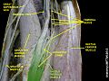 Vastus medialis muscle