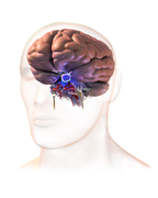 Pituitary Tumor.png