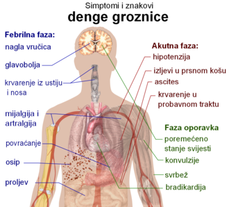 Obris torza sa strjelicama koje označavaju zahvaćene organe u različitim stadijima groznice