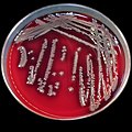 Aeromonas hydrophila colonies growing on the blood agar.