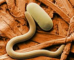 Imaxe de MEV coloreada dun nematodo Heterodera glycines e un dos seus ovos. A coloración artificial fai que a imaxe sexa máis fácil de ver por non especialistas e comprender as estruturas e superficies reveladas nas micrografías.