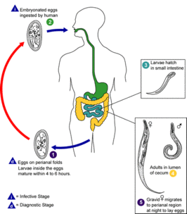 Enterobiasis