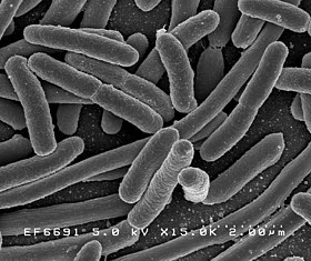 Elektronskomikroskopski snimak bacila Escherichia coli