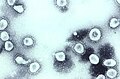 Etwa 17 Partikeln des Virus „humanes Coronavirus Organkultur 43“ (kurz: HCoV-OC43) mit den für Coronaviren typischen Fortsätzen, die an eine Sonnenkorona erinnern. Bild cyan-bläulich eingefärbt.