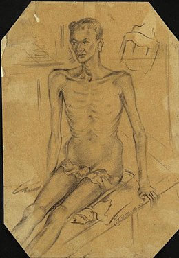 Description de l'image Dysentery Patient, Burma Hospital, Siam Art.IWMART1541787.jpg.