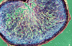 Dwarsdoorsnede graanvrucht onder een fasecontrastmicroscoop