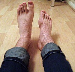 Shown here, the right foot drops due to paralysis of the tibialis anterior muscle, while the left foot demonstrates normal lifting abilities.