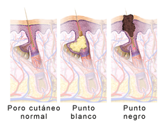 Blausen 0811 SkinPores.es.png