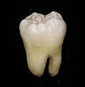 Thumbnail for Molar (tooth)