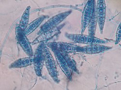 Macroconidia van de schimmel Microsporum canis