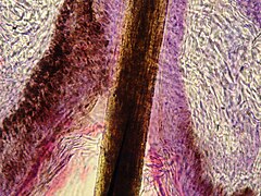 Hair follicle of feline - Microscopic view 1.jpg