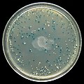 E. coli colonies transformed with plasmid DNA.