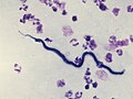 Microfilariae of Loa loa.