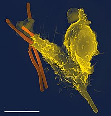 Long rod-shaped bacteria, one of which has been partially engulfed by a larger blob-shaped white blood cell. the shape of the cell is distorted by undigested bacterium inside it.