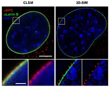 Порівняння роздільної здатності, отриманої за допомогою конфокальної лазерної скануючої мікроскопії (ліворуч) і 3D-мікроскопії зі структурованим освітленням (3D-SIM-мікроскопія, праворуч). Верхні зображення показують ядро ​​клітини миші, білі прямокутники збільшені внизу. Ядерні пори (анти-NPC, червоний) ядерна оболонка (анти-Ламін, зелений). Хроматин/ДНК (DAPI, синій).