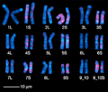 Chromosomenkarte X. laevis [21], Karyotyp