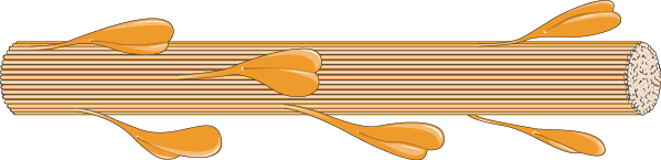 Rheumatology - Myosin 4 -- Smart-Servier.png