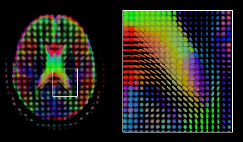 File:DiffusionMRI glyphs.png