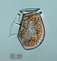 The dinoflagellate Dinophysis acuta