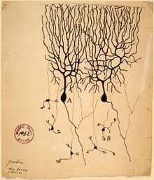 A drawing on yellowing paper with an archiving stamp in the corner. A spidery tree branch structure connects to the top of a mass. A few narrow processes follow away from the bottom of the mass.