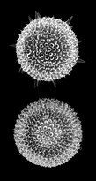 Shell of a spherical radiolarian