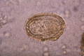 Schistosoma japonicum