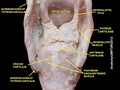 Larynx. Deep dissection. Posterior view.