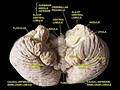 Cerebellum. Inferior surface.