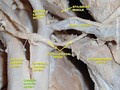 Common carotid artery