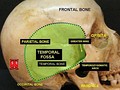 Visión lateral del cráneo, en la que se observa la fosa temporal (en inglés, temporal fossa), la cual incluye al hueso parietal, además del hueso frontal y hueso occipital.