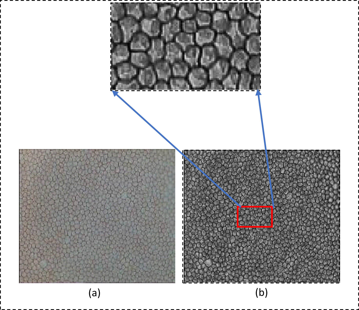 Figure 6 
                     The effect of CLAHE for sample 1: (a) the original image and (b) the filtered image.
                  