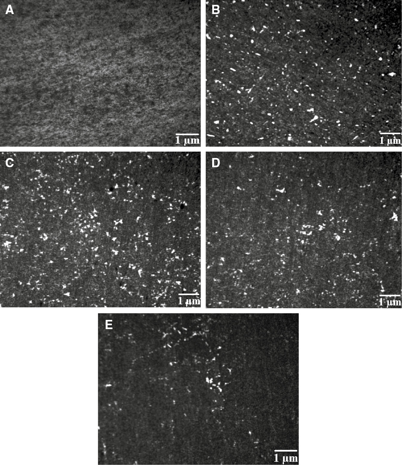 Figure 5: Microstructures of (A) unreinforced Al alloy (B) homogeneous composite (C) FGM – outer surface (D) FGM – middle surface and (E) FGM – inner surface.