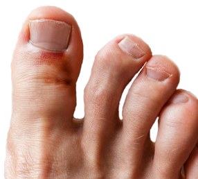 Toe Png